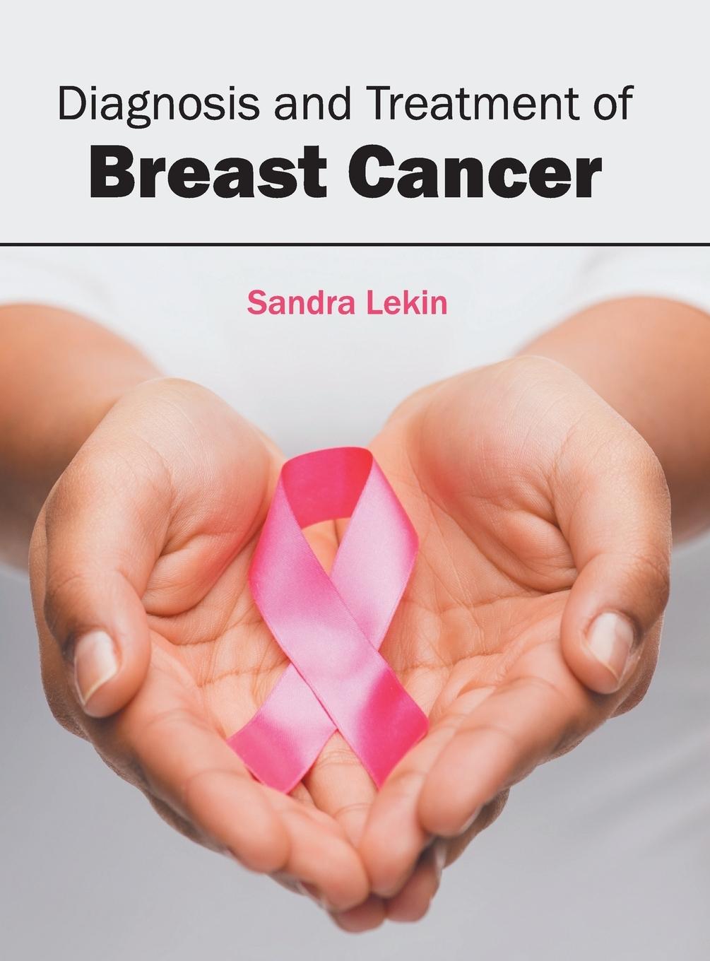 Vorderes Coverbild Diagnosis and Treatment of Breast Cancer