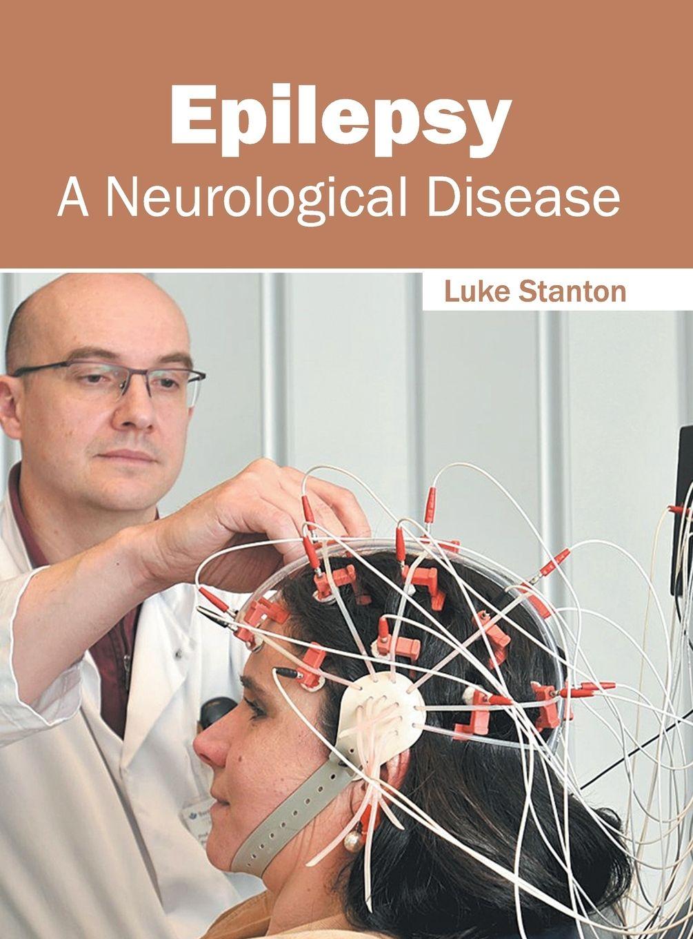 Vorderes Coverbild Epilepsy