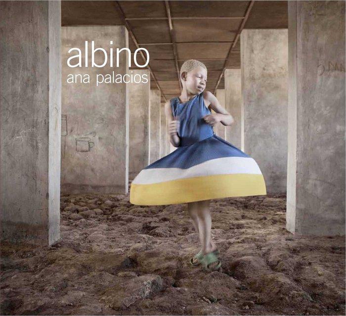Vorderes Coverbild Albino