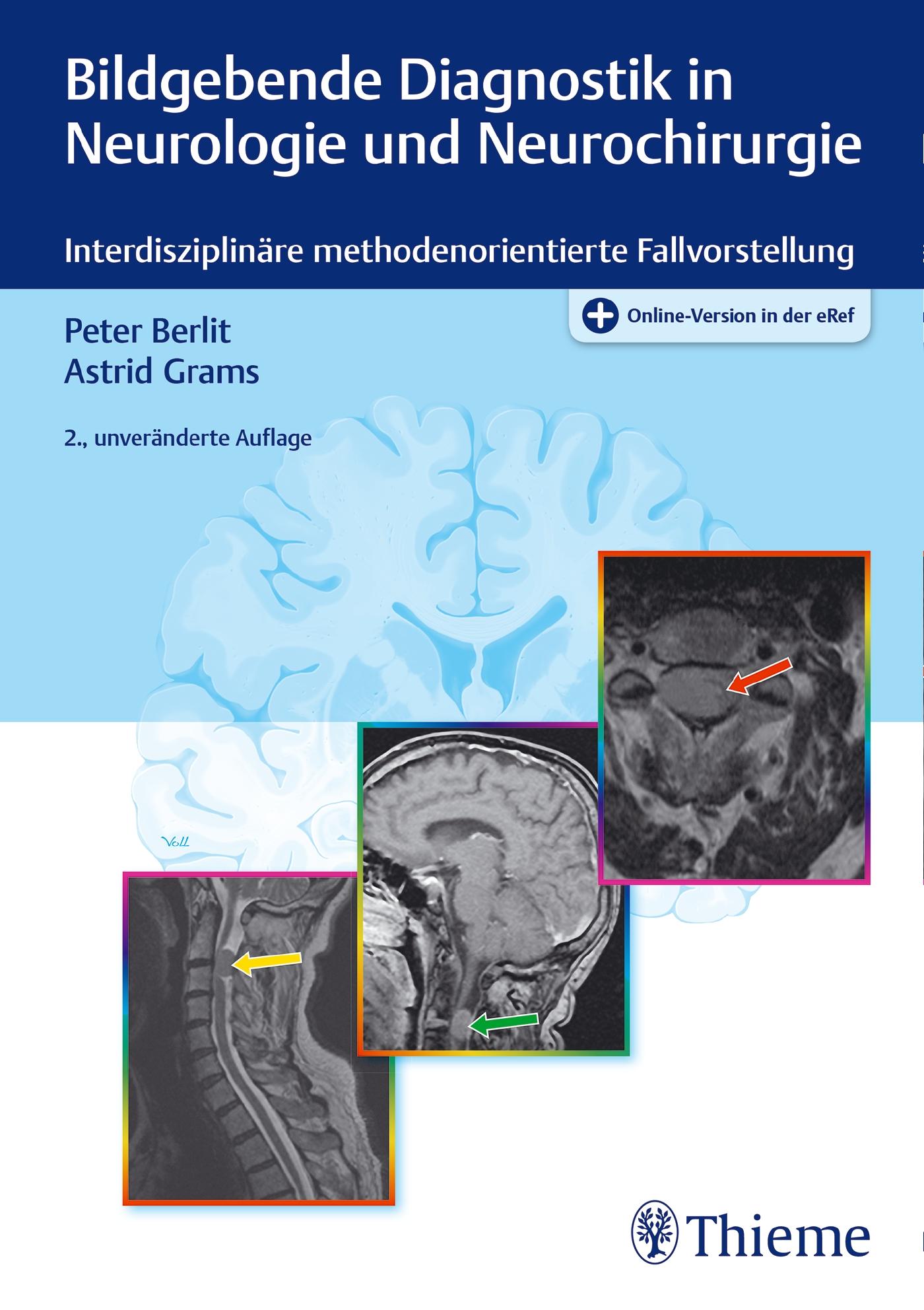 Vorderes Coverbild Bildgebende Diagnostik in Neurologie und Neurochirurgie