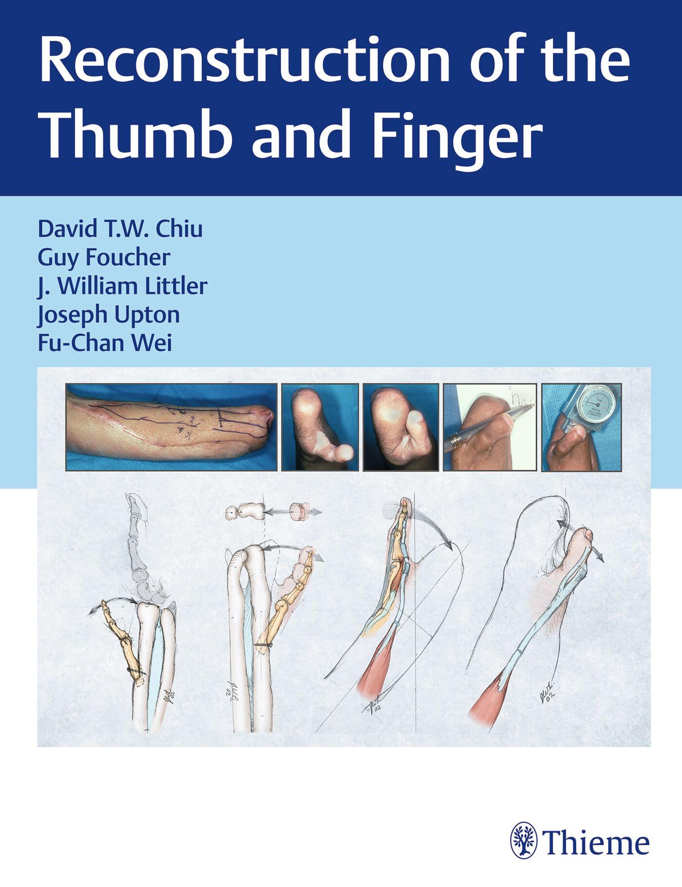 Vorderes Coverbild Reconstruction of the Thumb and Finger