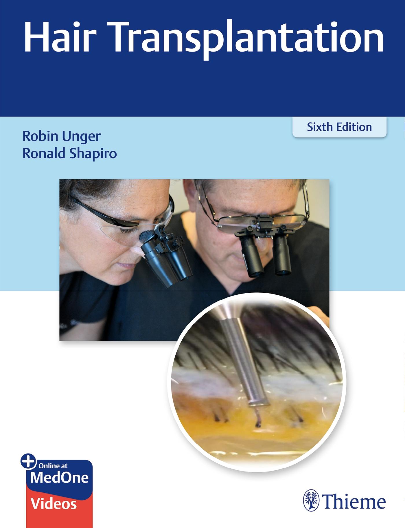 Vorderes Coverbild Hair Transplantation