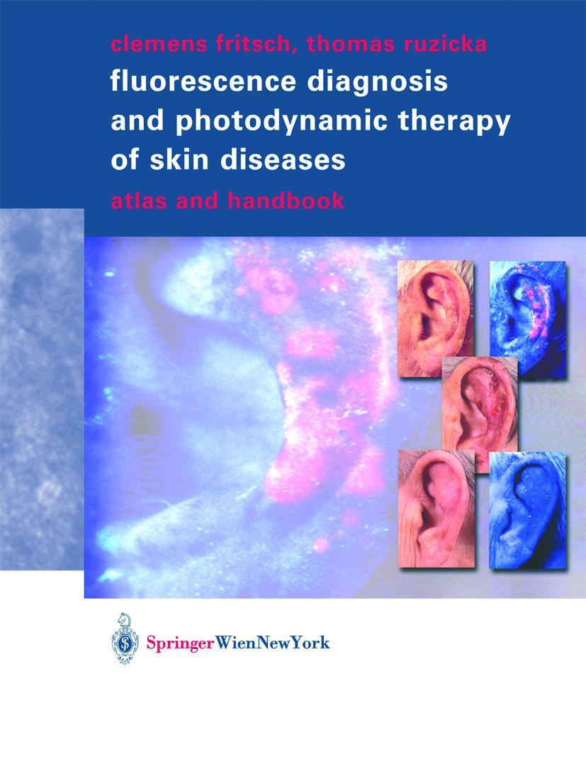 Vorderes Coverbild Fluorescence Diagnosis and Photodynamic Therapy of Skin Diseases