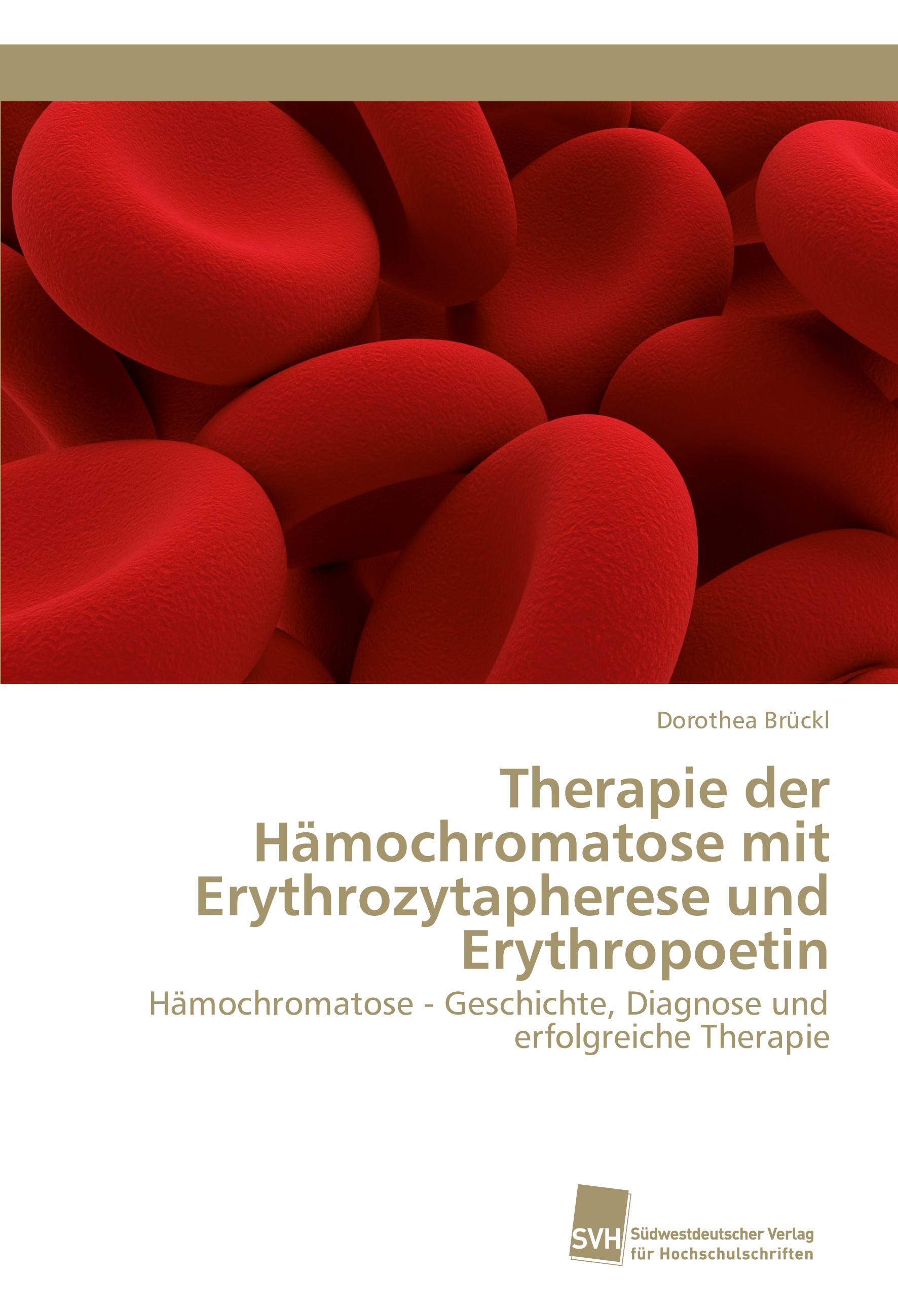 Vorderes Coverbild Therapie der Hämochromatose mit Erythrozytapherese und Erythropoetin