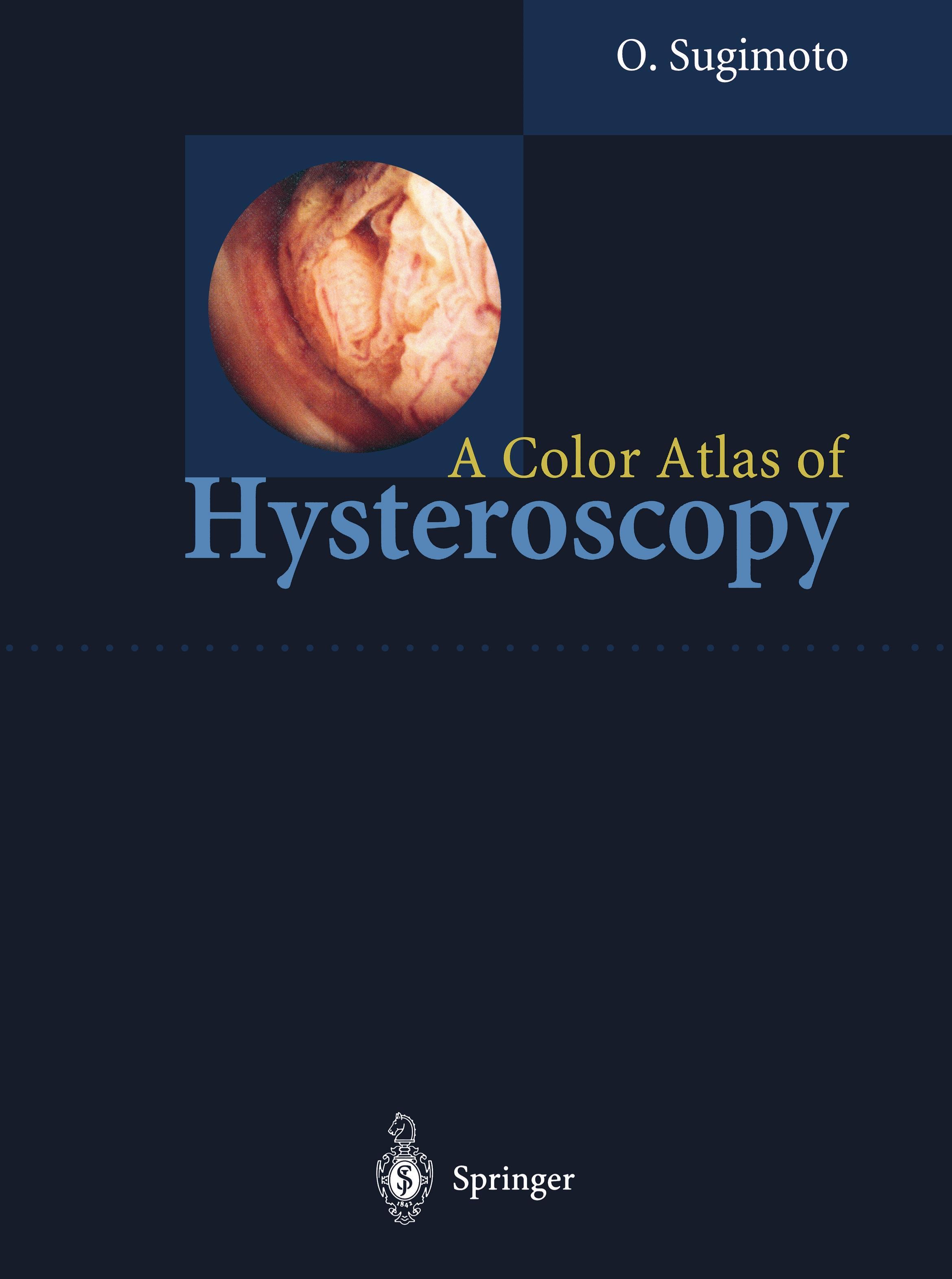 Vorderes Coverbild A Color Atlas of Hysteroscopy