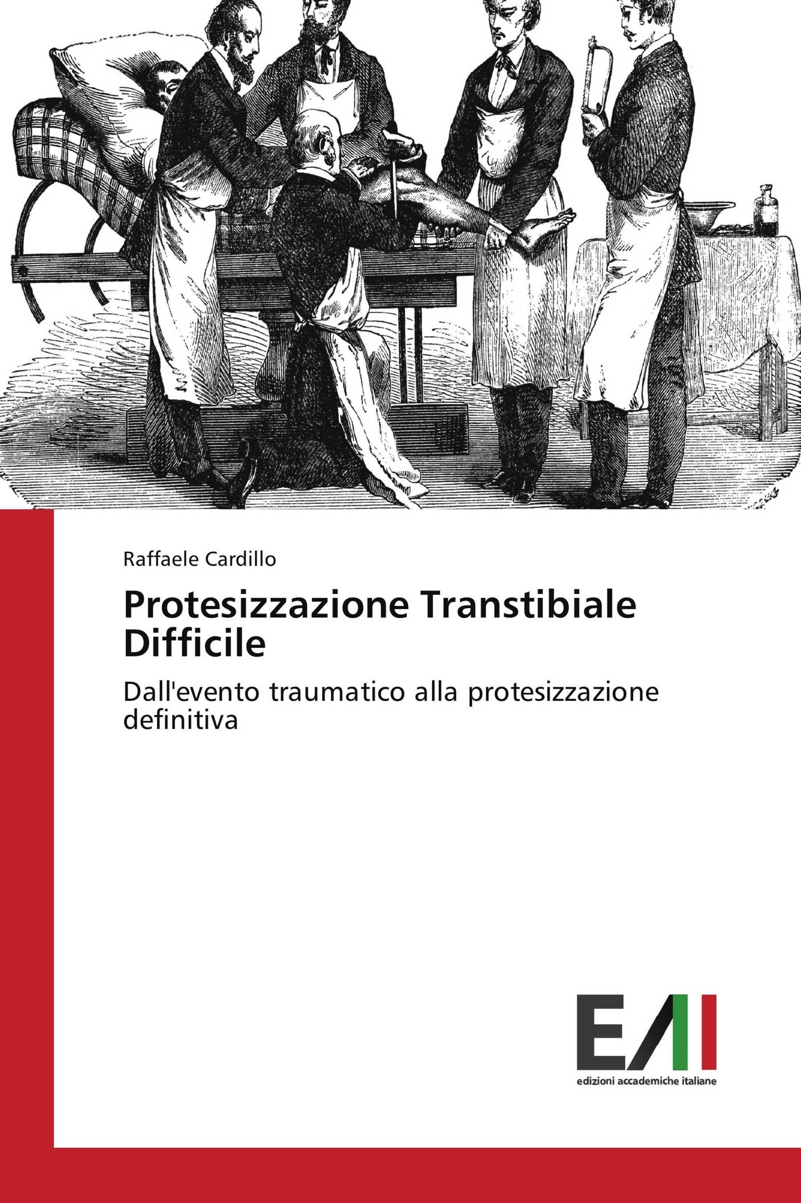 Vorderes Coverbild Protesizzazione Transtibiale Difficile