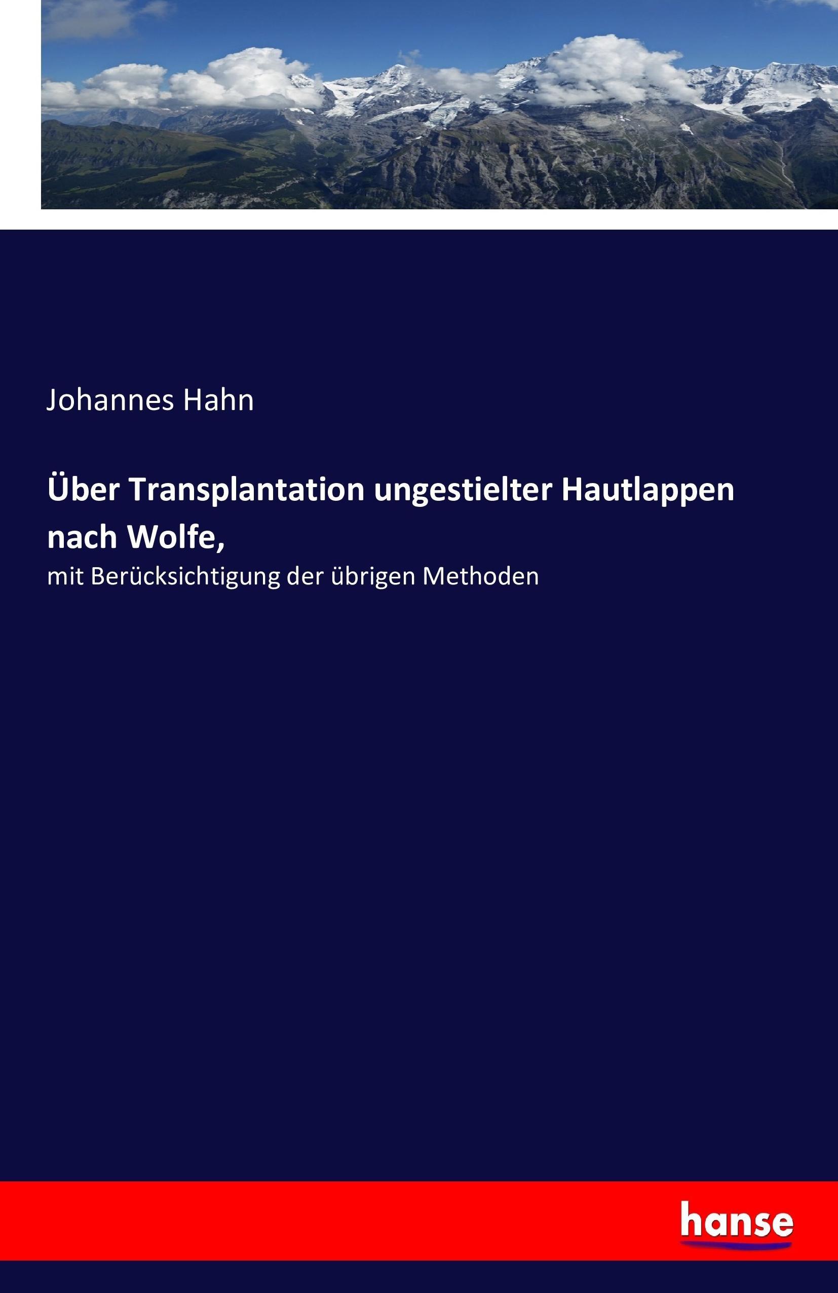 Vorderes Coverbild Über Transplantation ungestielter Hautlappen nach Wolfe,