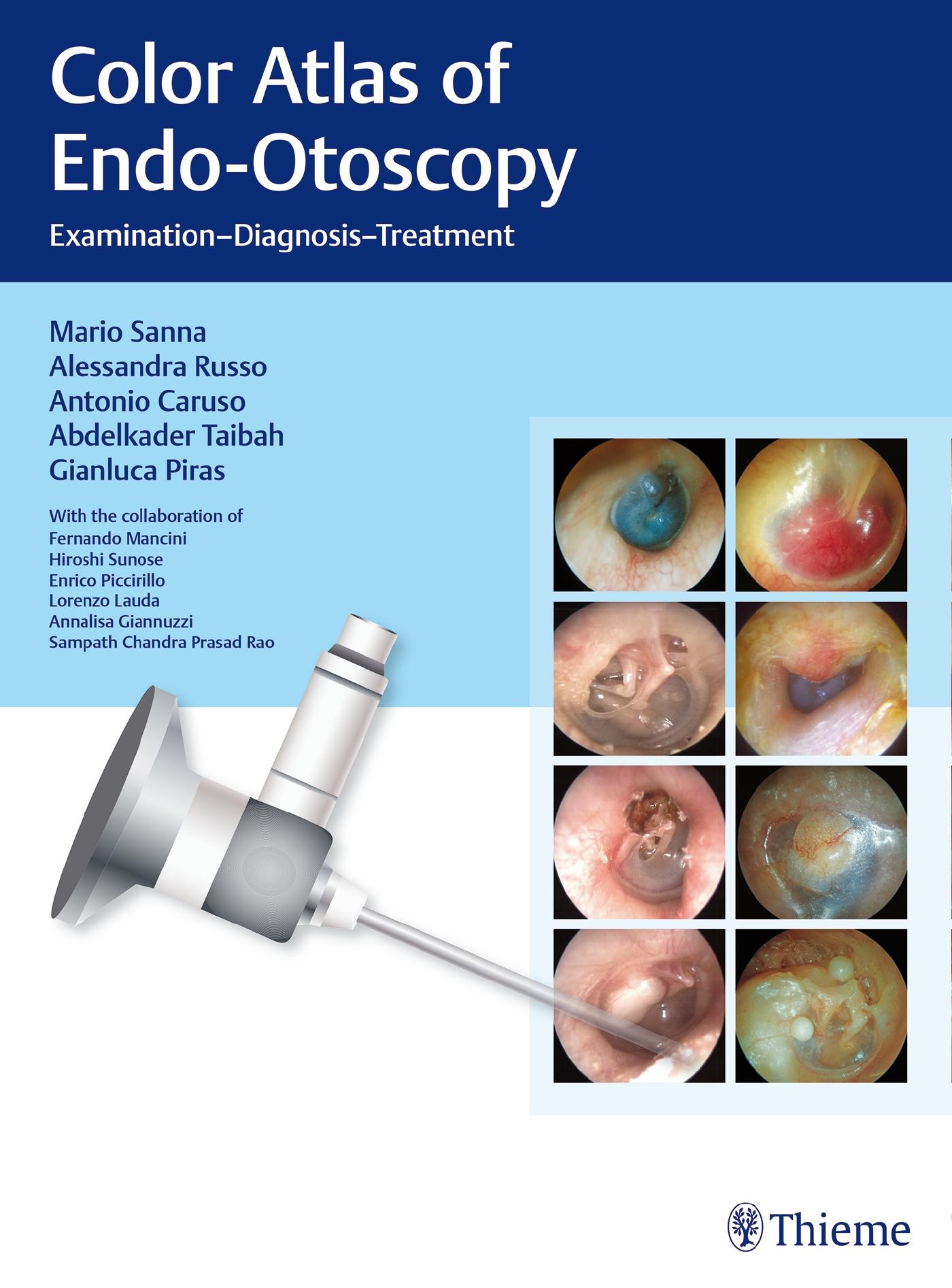 Vorderes Coverbild Color Atlas of Endo-Otoscopy