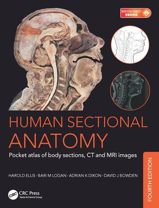Vorderes Coverbild Human Sectional Anatomy