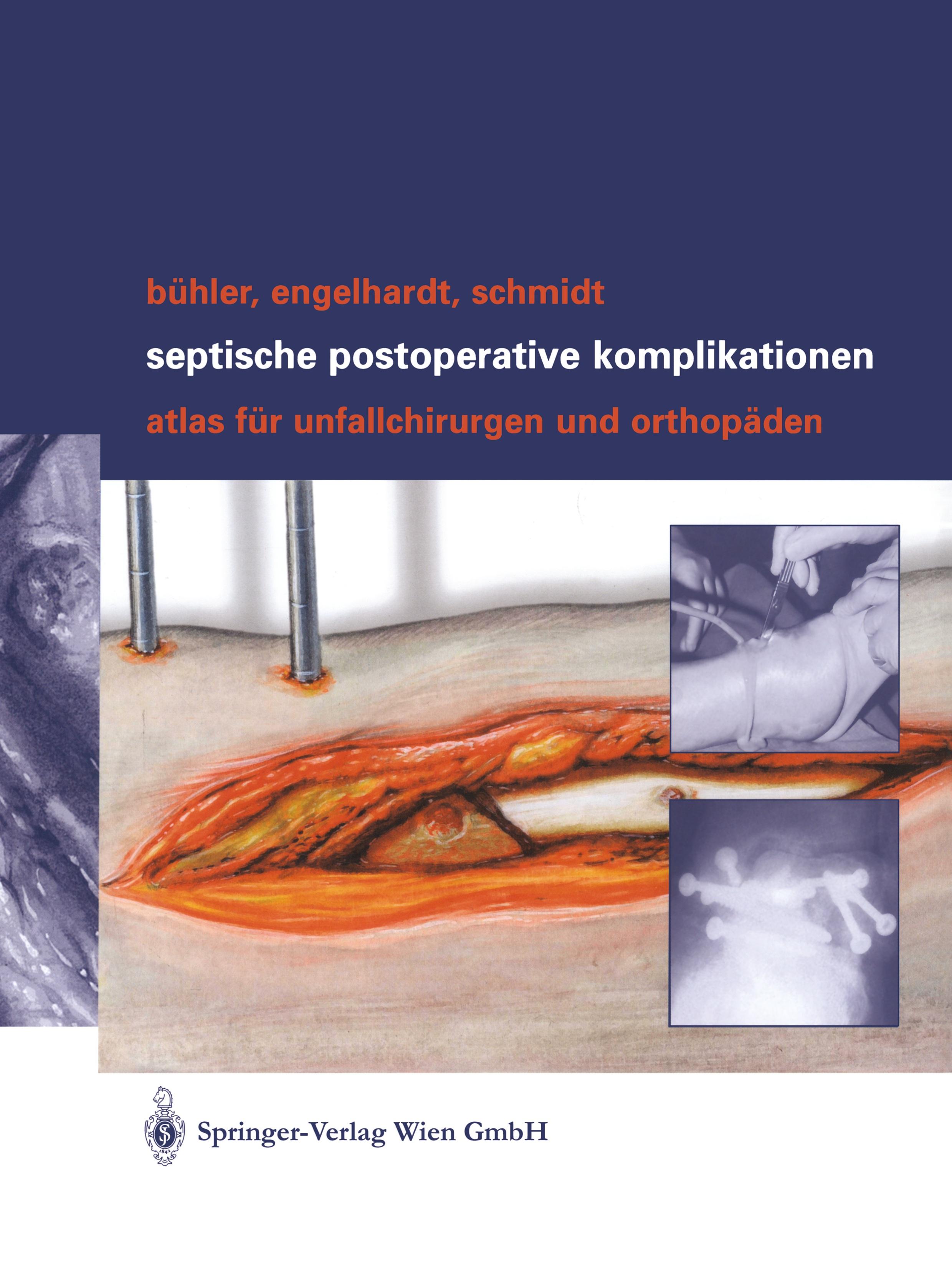 Vorderes Coverbild Septische postoperative Komplikationen