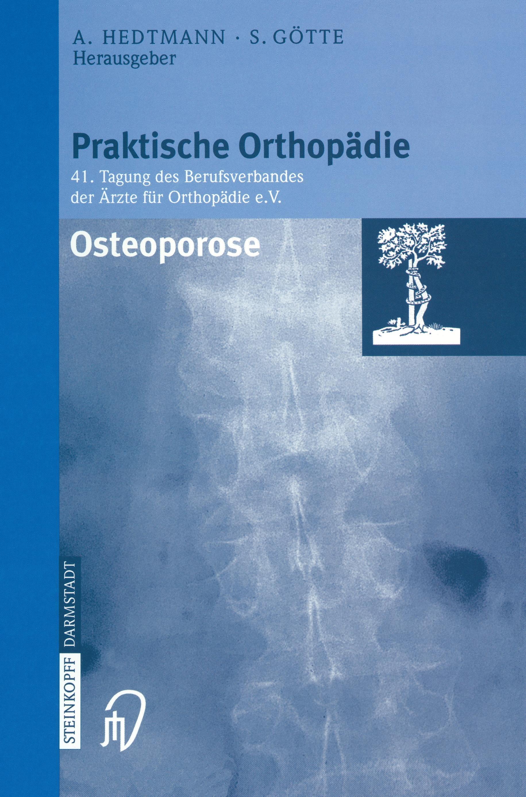Vorderes Coverbild Osteoporose