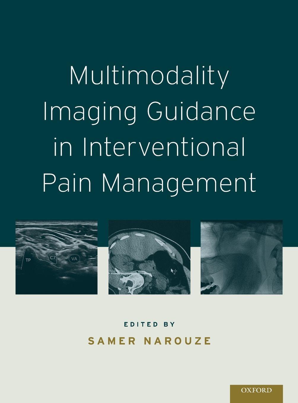 Vorderes Coverbild Multimodality Imaging Guidance in Interventional Pain Management