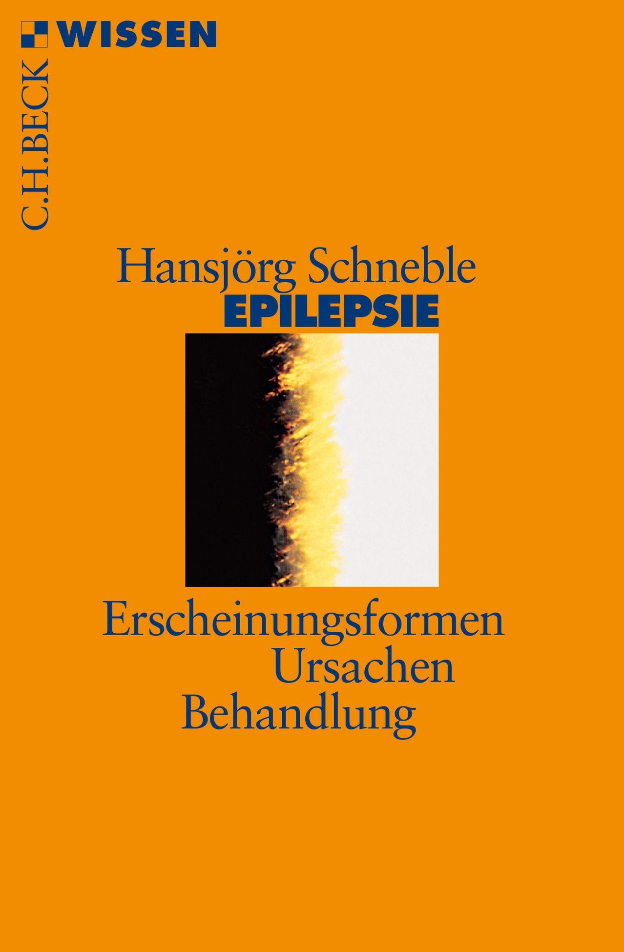 Vorderes Coverbild Epilepsie
