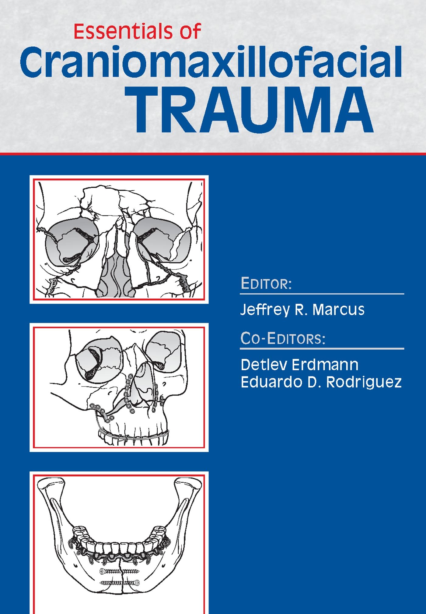 Vorderes Coverbild Essentials of Craniomaxillofacial Trauma