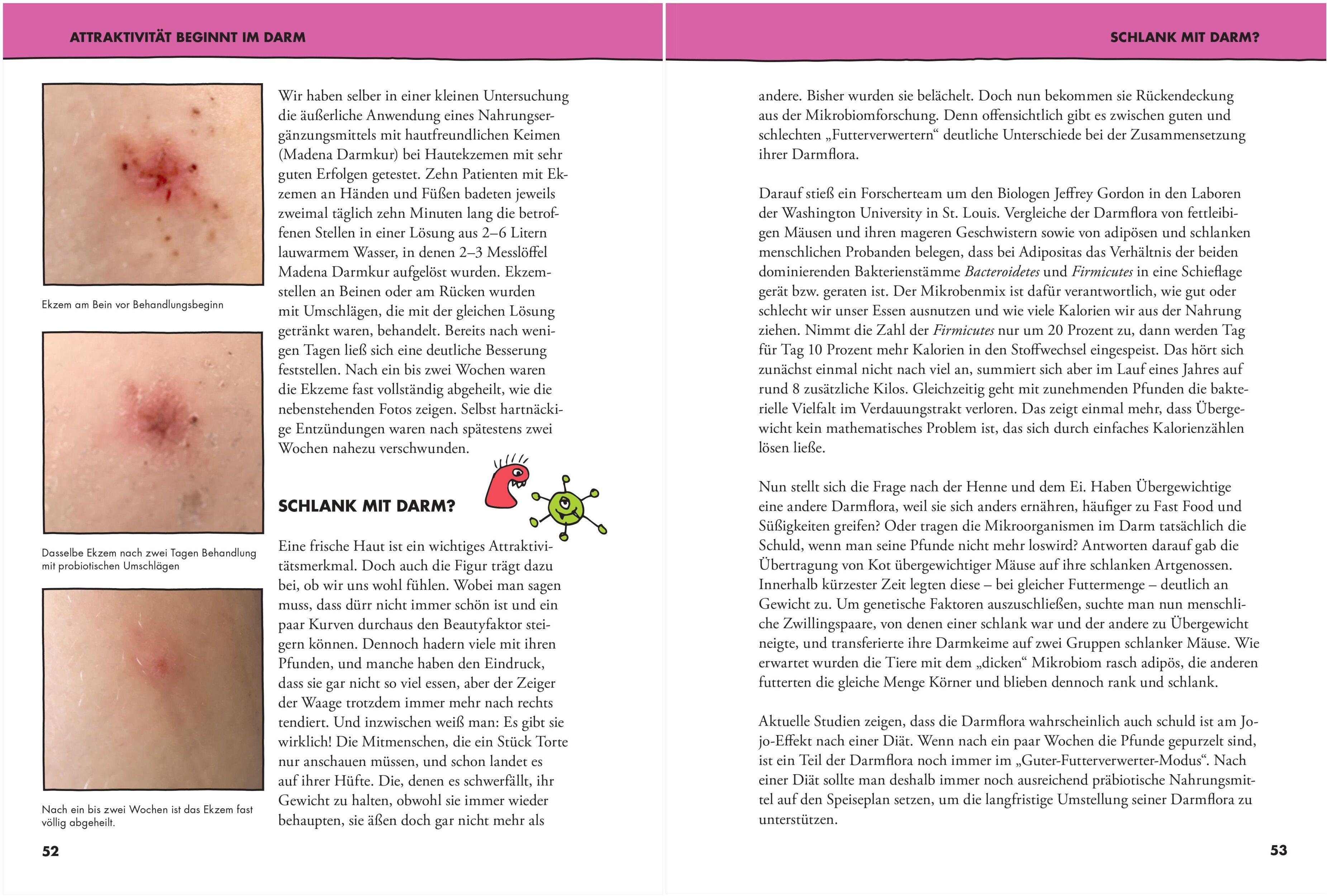 Beispielinhalt (Bild) Schön mit Darm