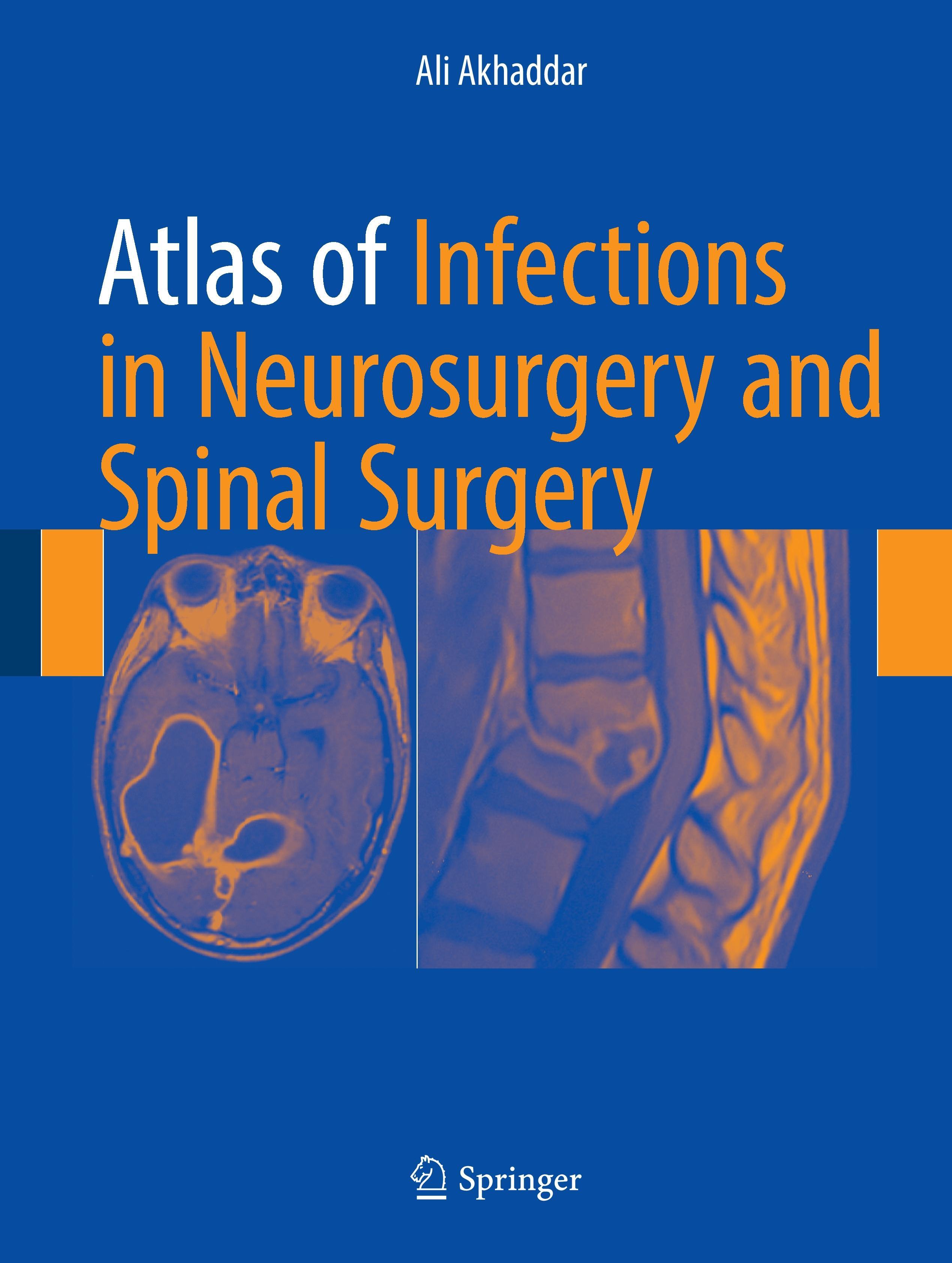 Vorderes Coverbild Atlas of Infections in Neurosurgery and Spinal Surgery