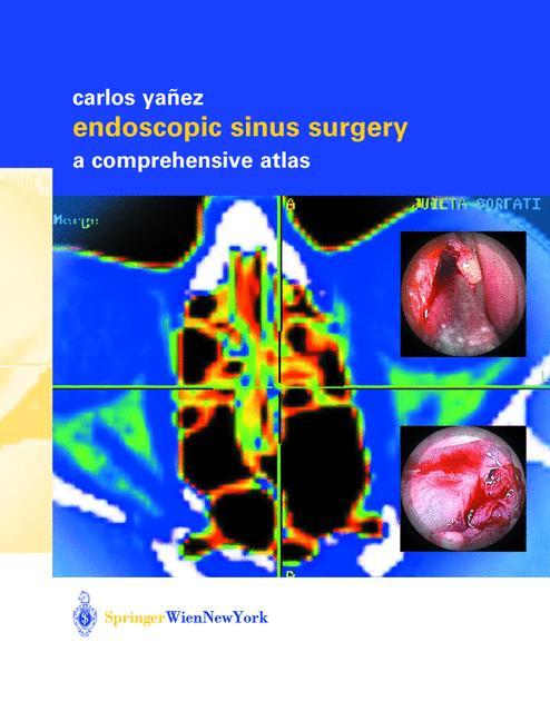Vorderes Coverbild Endoscopic Sinus Surgery