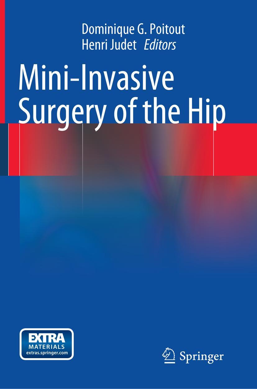 Vorderes Coverbild Mini-Invasive Surgery of the Hip