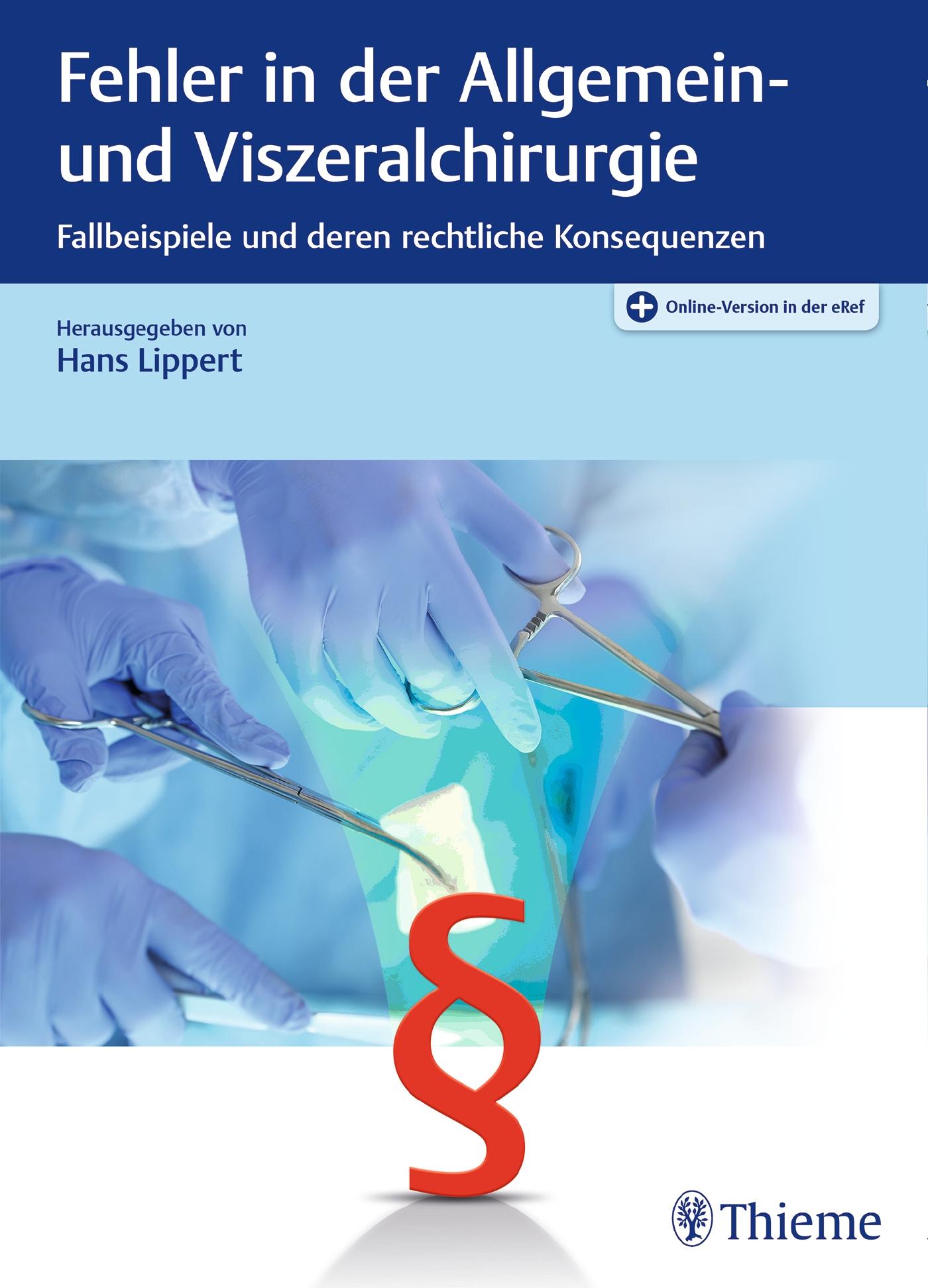Vorderes Coverbild Fehler in der Allgemein- und Viszeralchirurgie