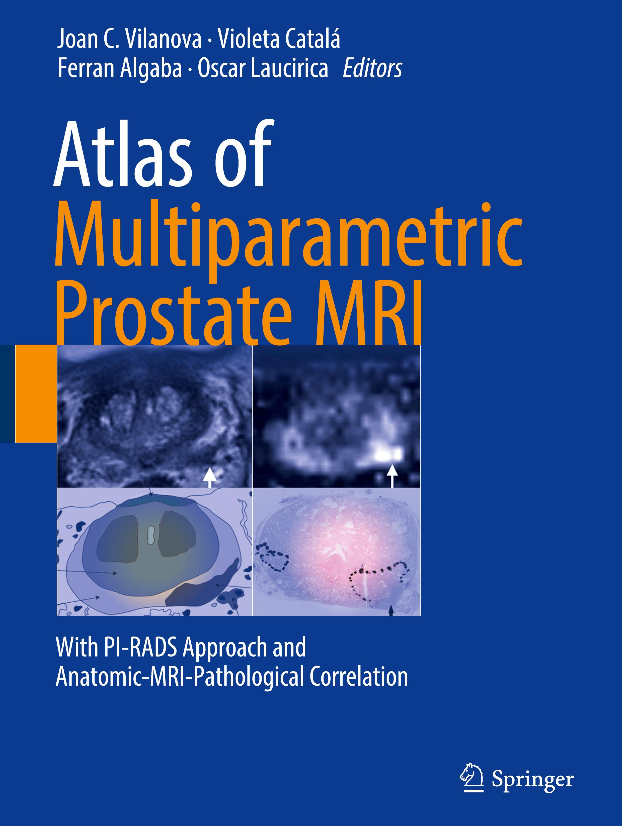 Vorderes Coverbild Atlas of Multiparametric Prostate MRI