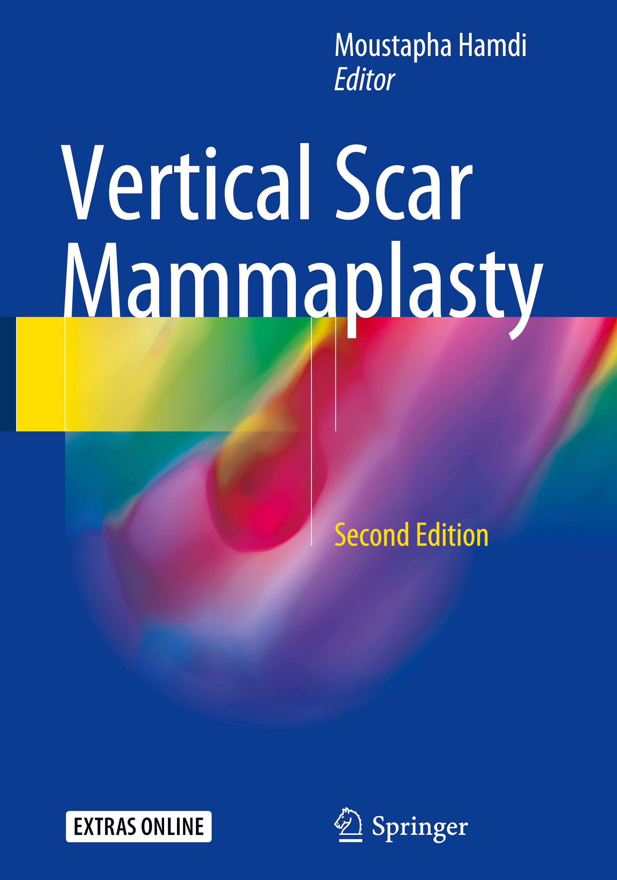 Vorderes Coverbild Vertical Scar Mammaplasty