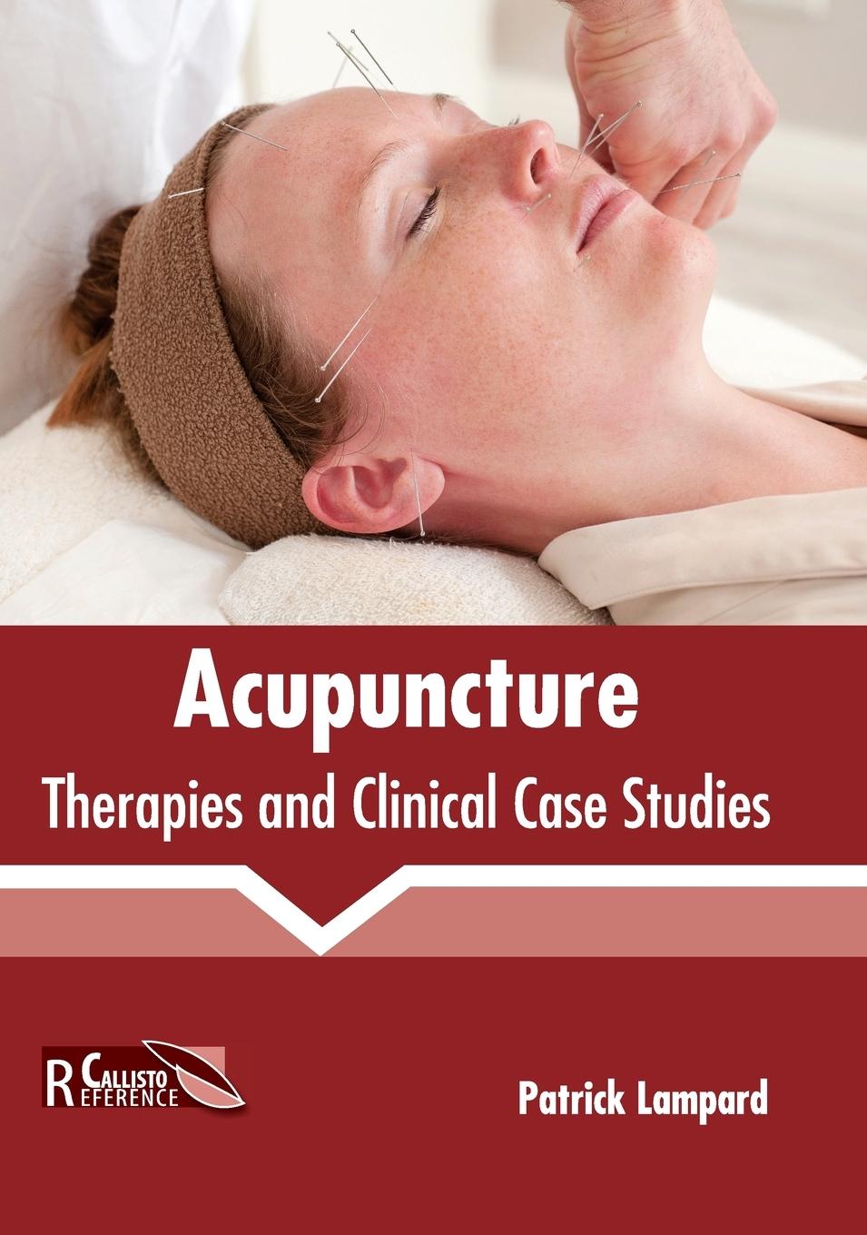 Vorderes Coverbild Acupuncture