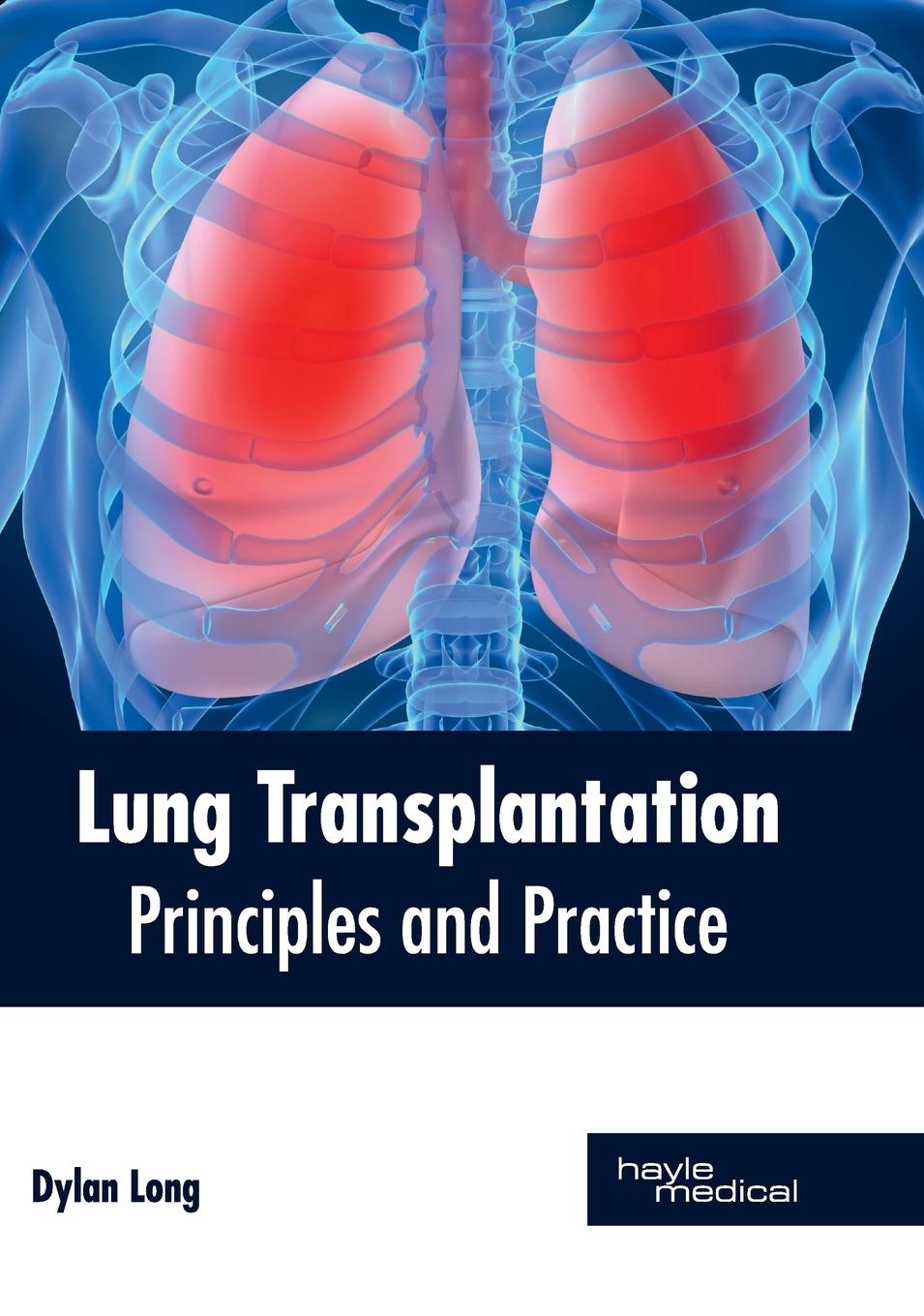 Vorderes Coverbild Lung Transplantation