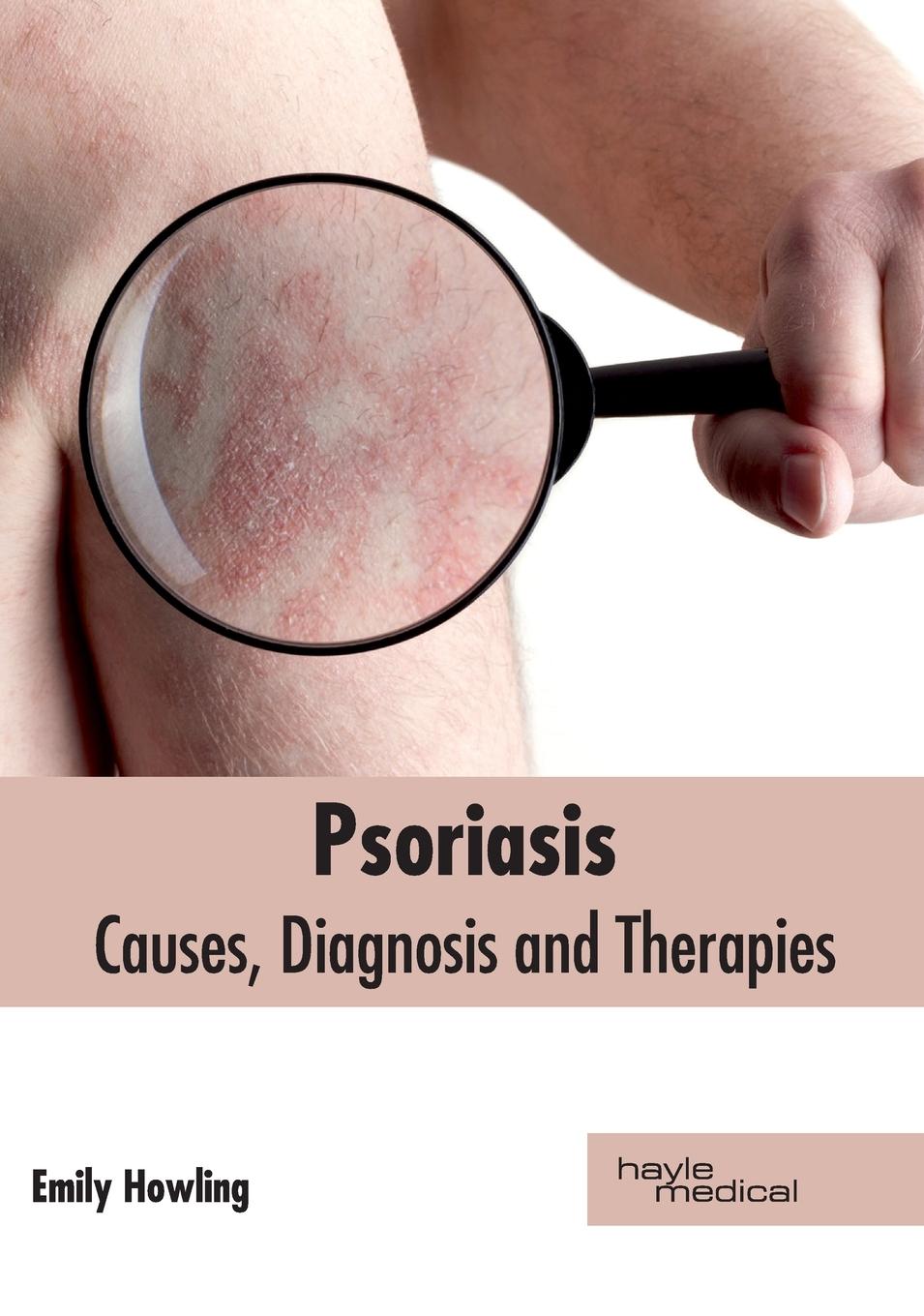 Vorderes Coverbild Psoriasis