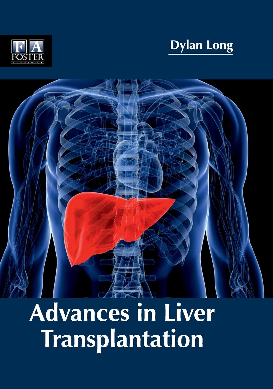 Vorderes Coverbild Advances in Liver Transplantation