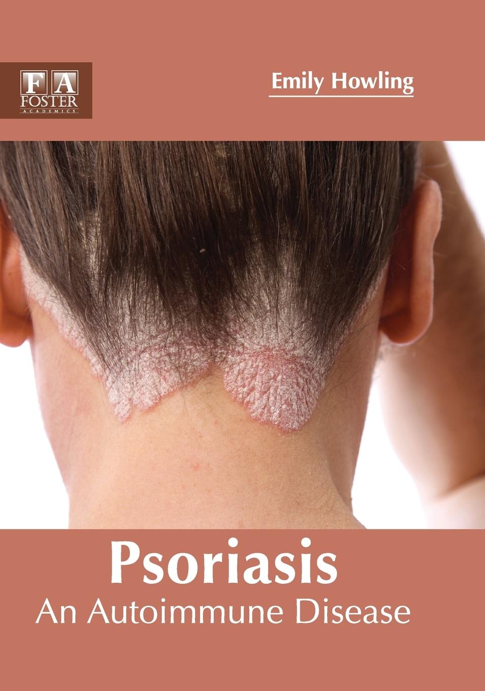 Vorderes Coverbild Psoriasis