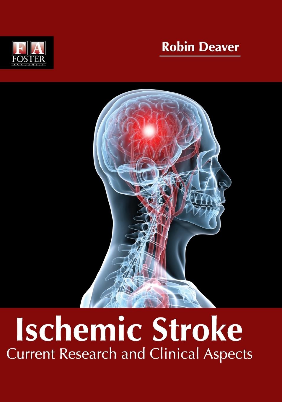 Vorderes Coverbild Ischemic Stroke