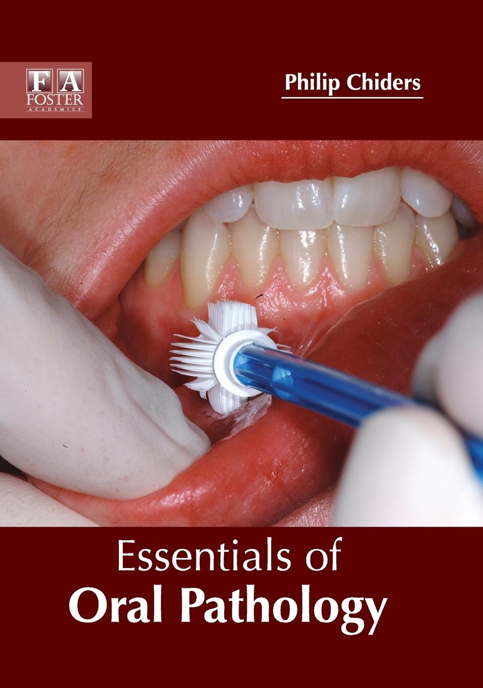 Vorderes Coverbild Essentials of Oral Pathology