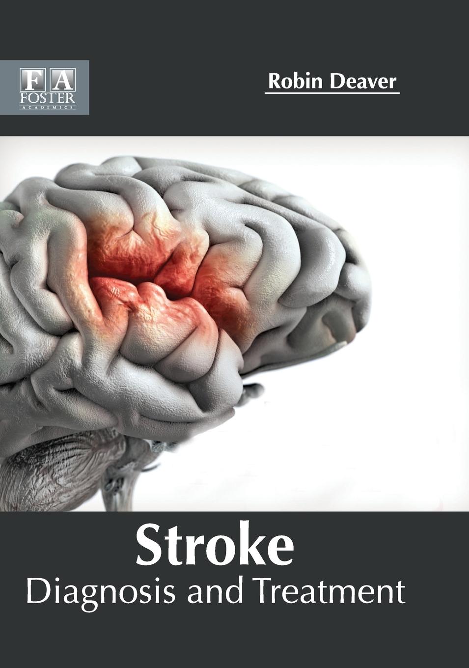 Vorderes Coverbild Stroke
