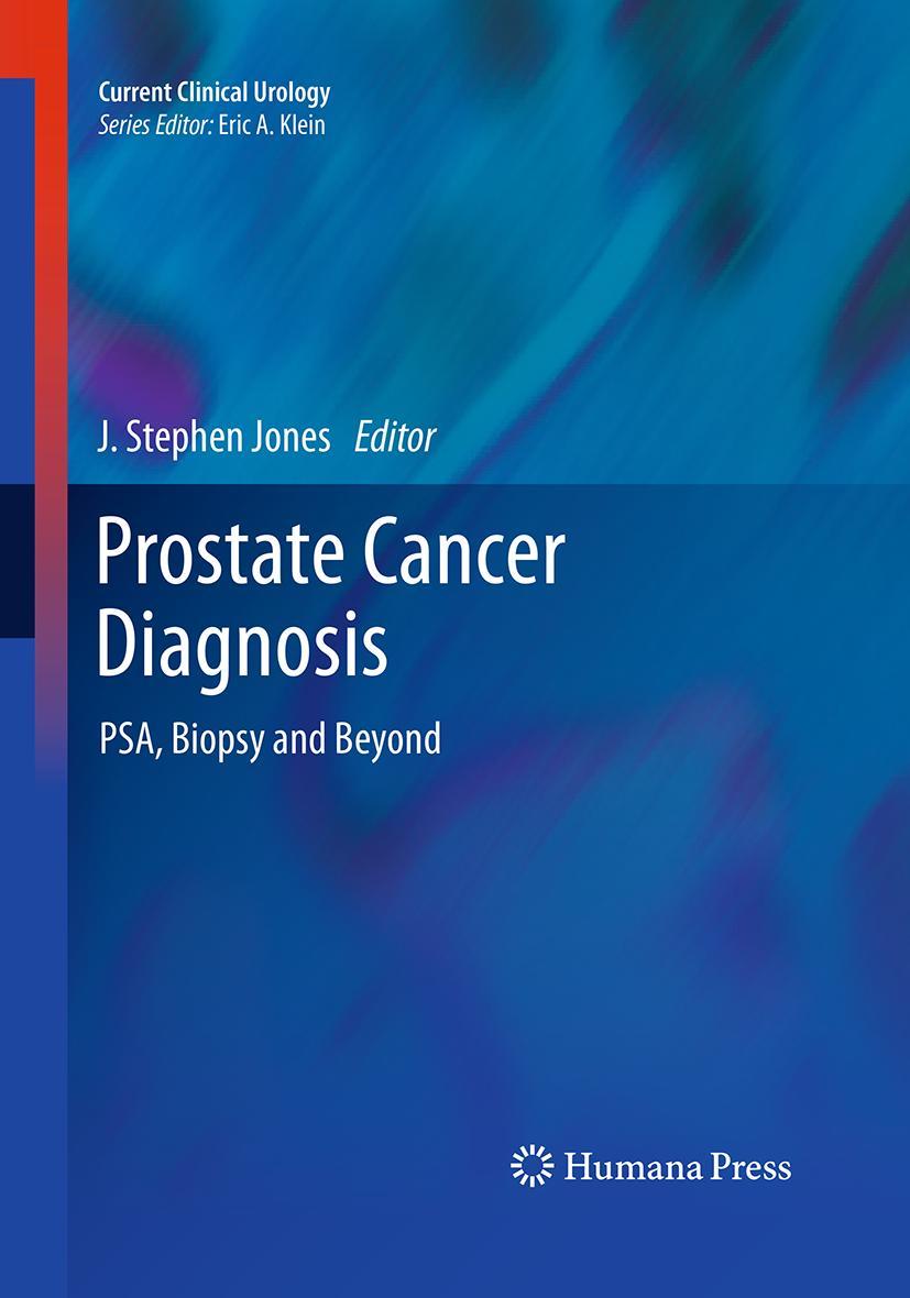Vorderes Coverbild Prostate Cancer Diagnosis