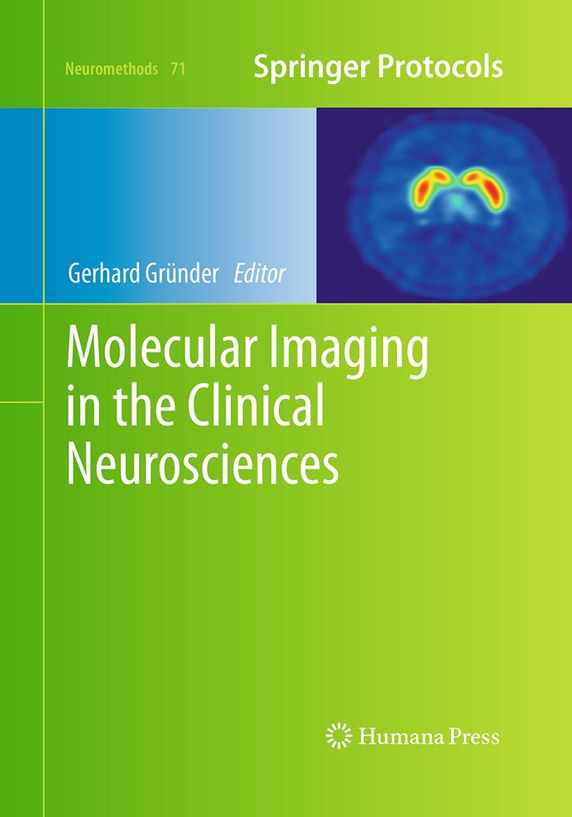 Vorderes Coverbild Molecular Imaging in the Clinical Neurosciences