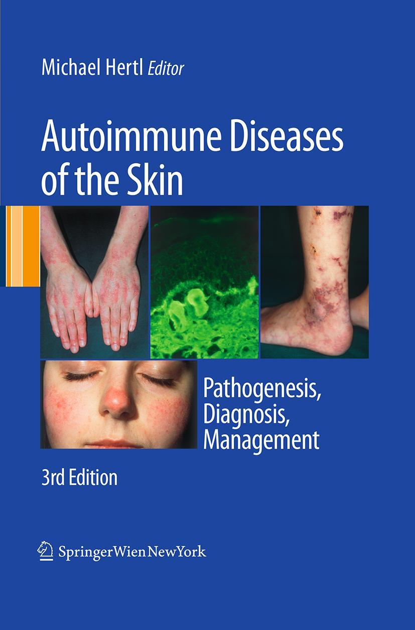 Vorderes Coverbild Autoimmune Diseases of the Skin