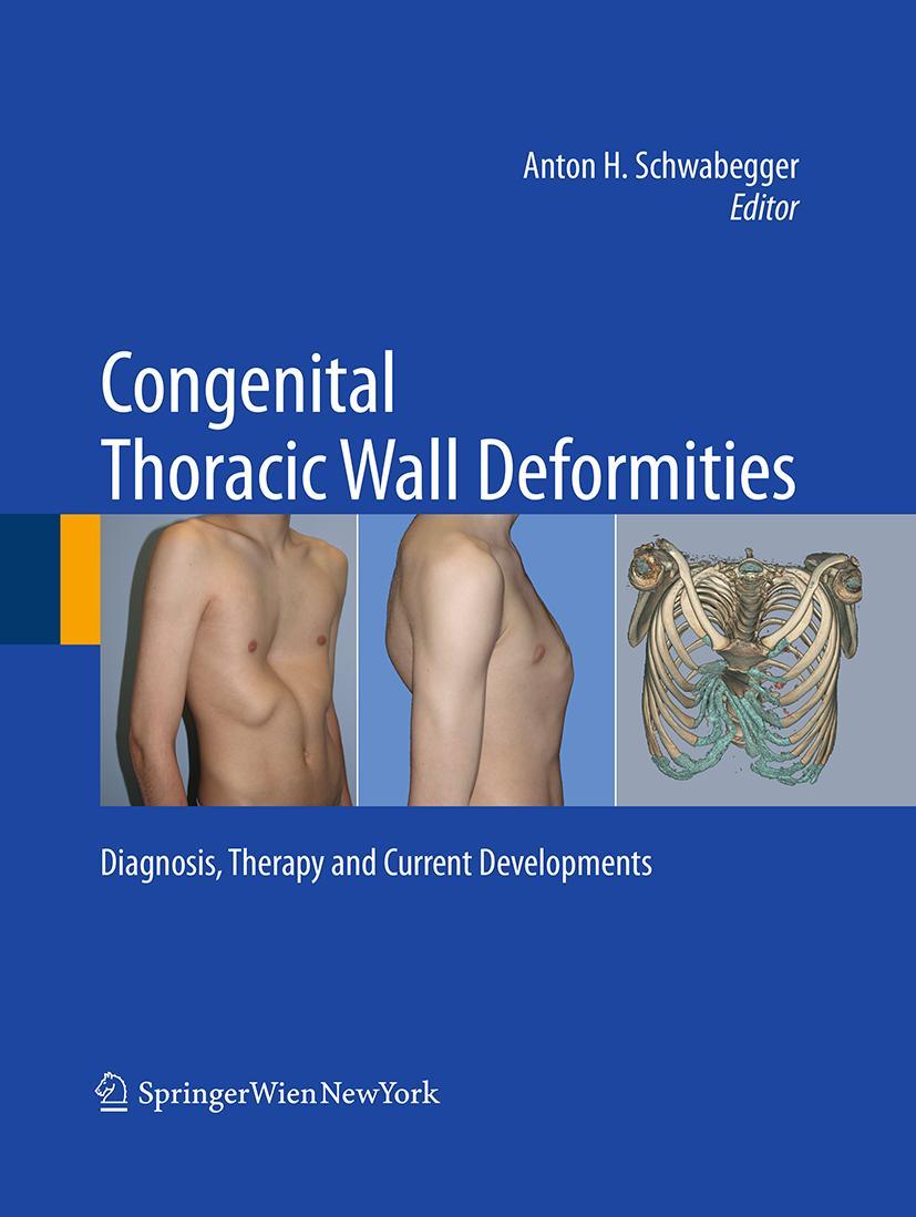Vorderes Coverbild Congenital Thoracic Wall Deformities