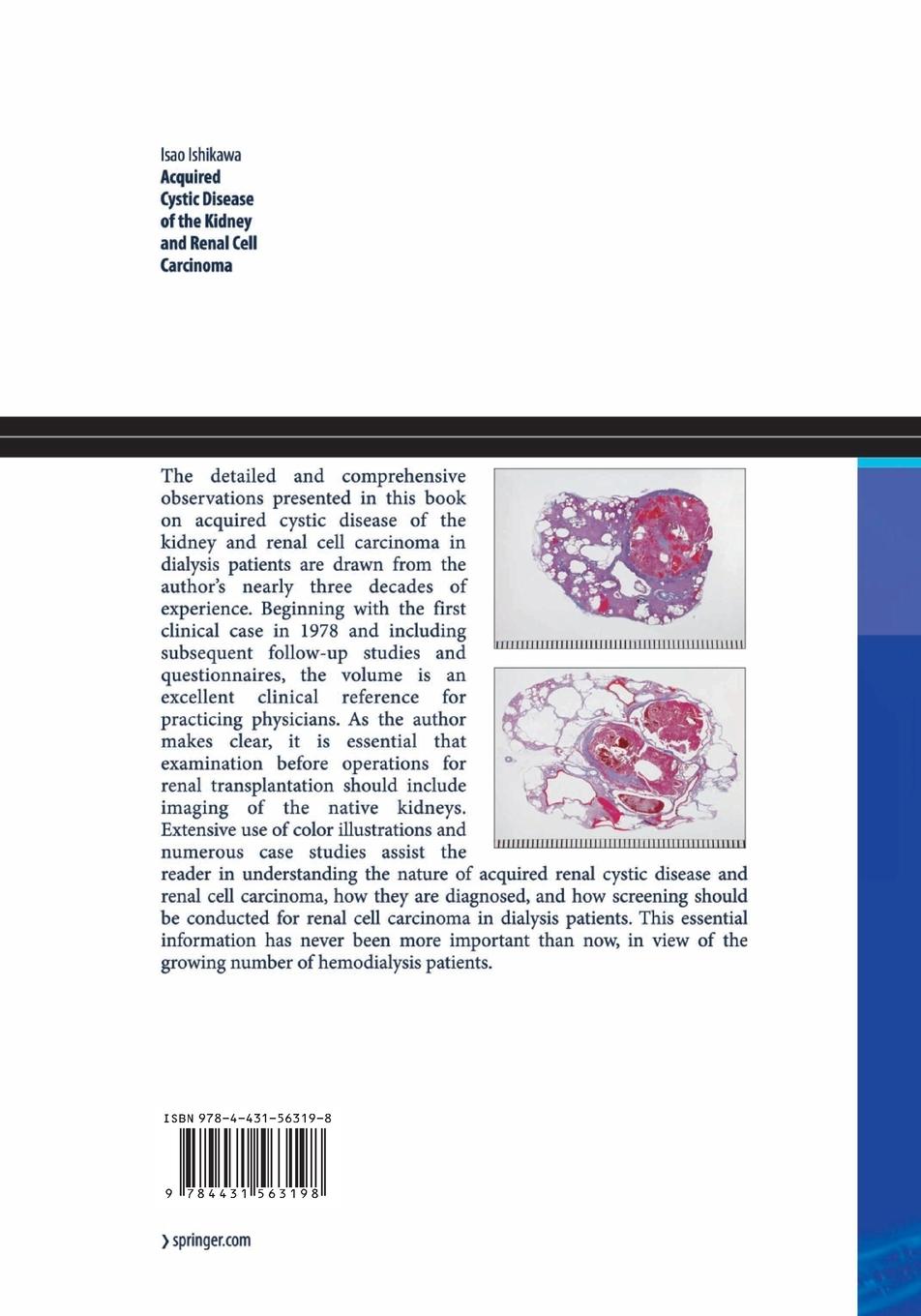 Rückseitencover Acquired Cystic Disease of the Kidney and Renal Cell Carcinoma