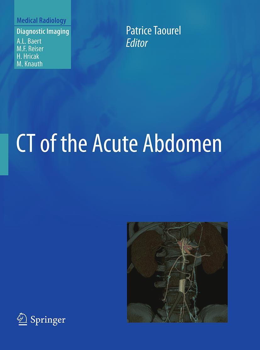 Vorderes Coverbild CT of the Acute Abdomen