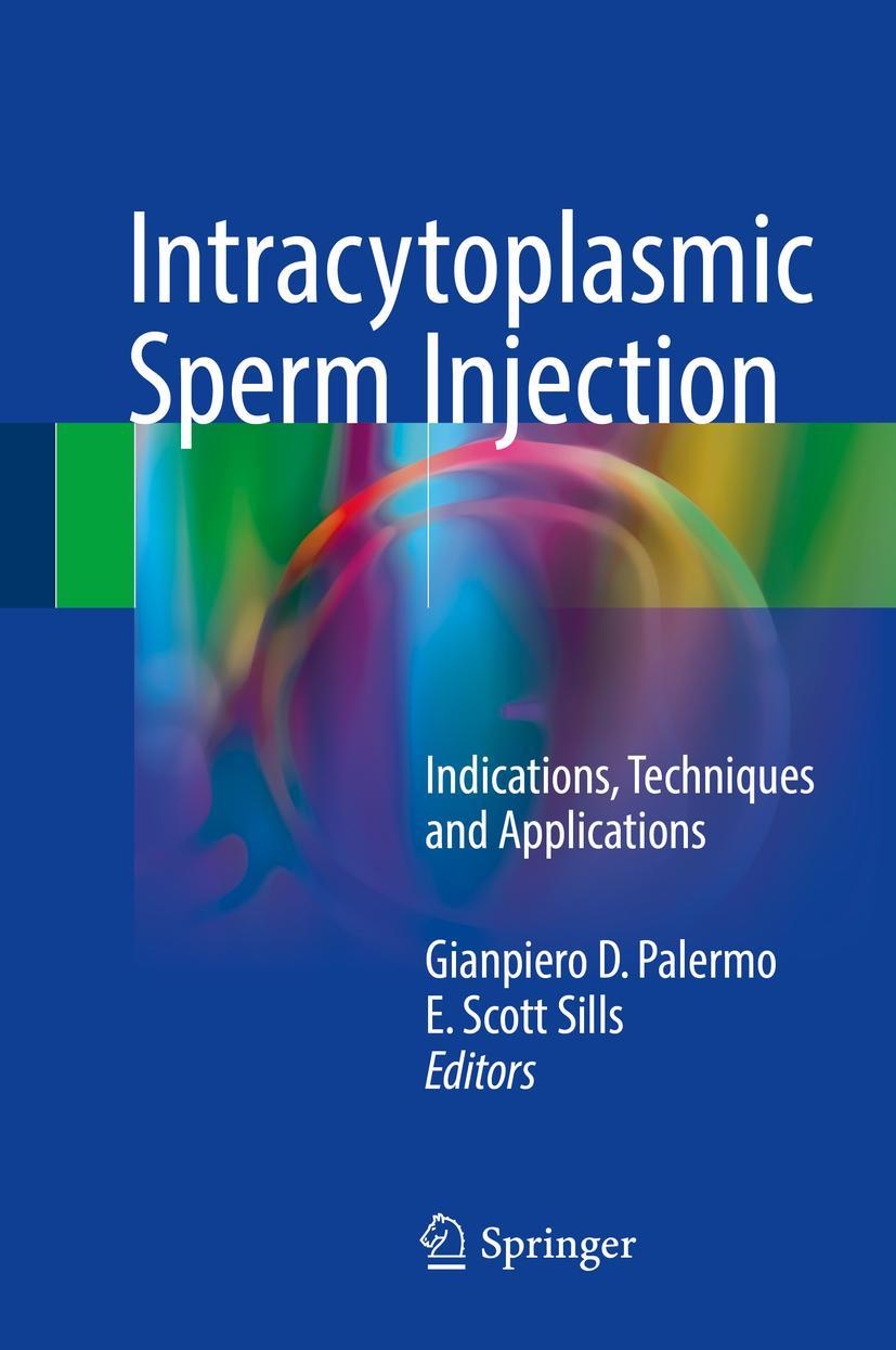 Vorderes Coverbild Intracytoplasmic Sperm Injection