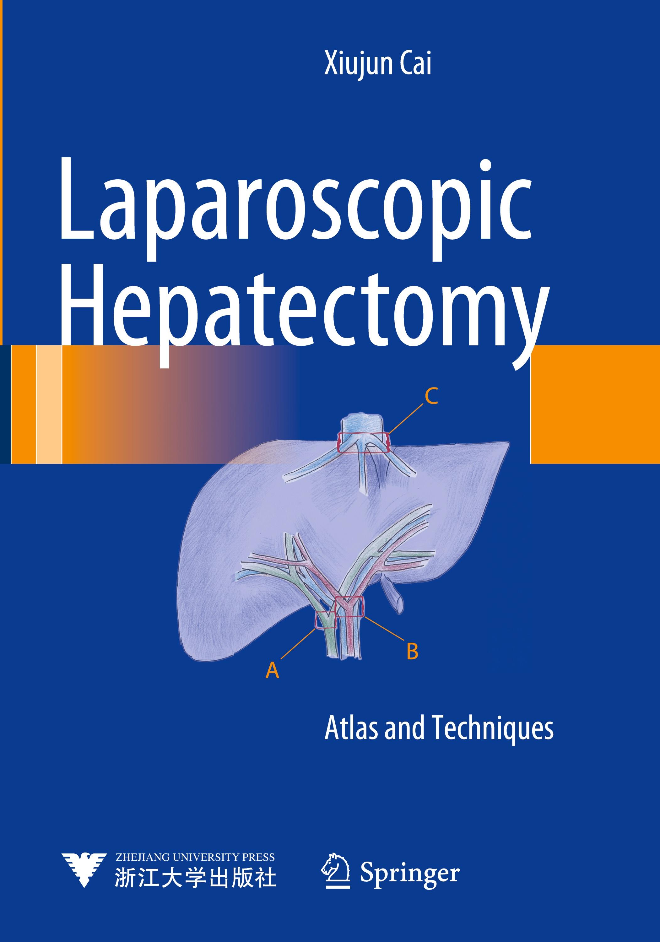 Vorderes Coverbild Laparoscopic Hepatectomy
