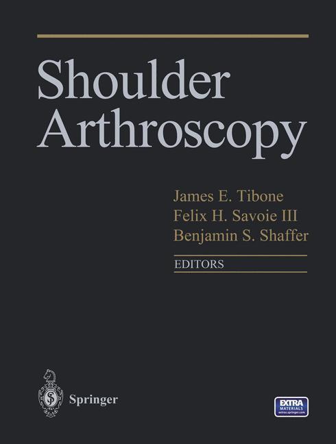 Beispielinhalt (Bild) Shoulder Arthroscopy