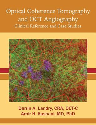 Vorderes Coverbild Optical Coherence Tomography and OCT Angiography: Clinical Reference and Case Studies