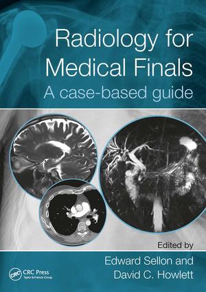 Vorderes Coverbild Radiology for Medical Finals