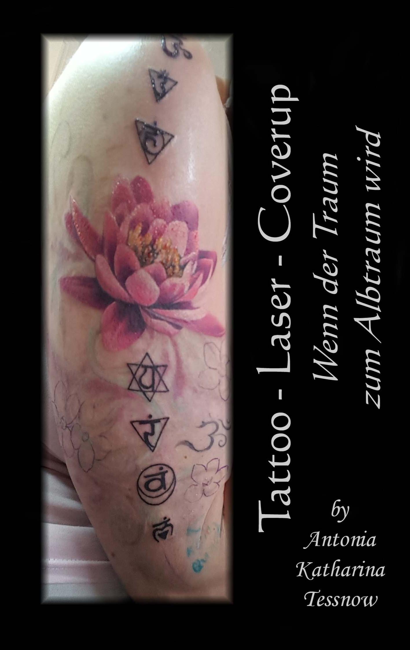 Vorderes Coverbild Tattoo - Laser - Cover Up