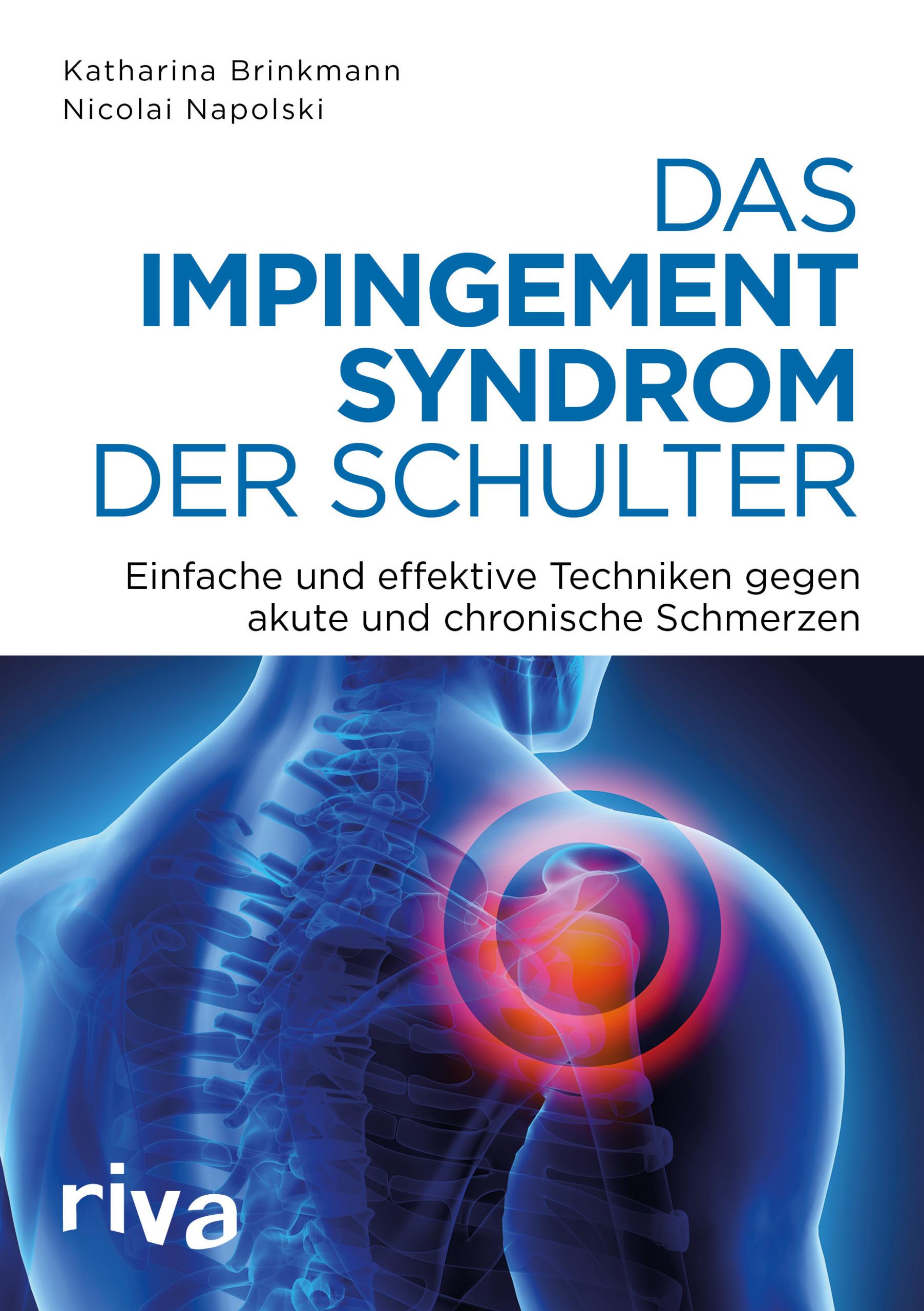 Vorderes Coverbild Das Impingement-Syndrom der Schulter