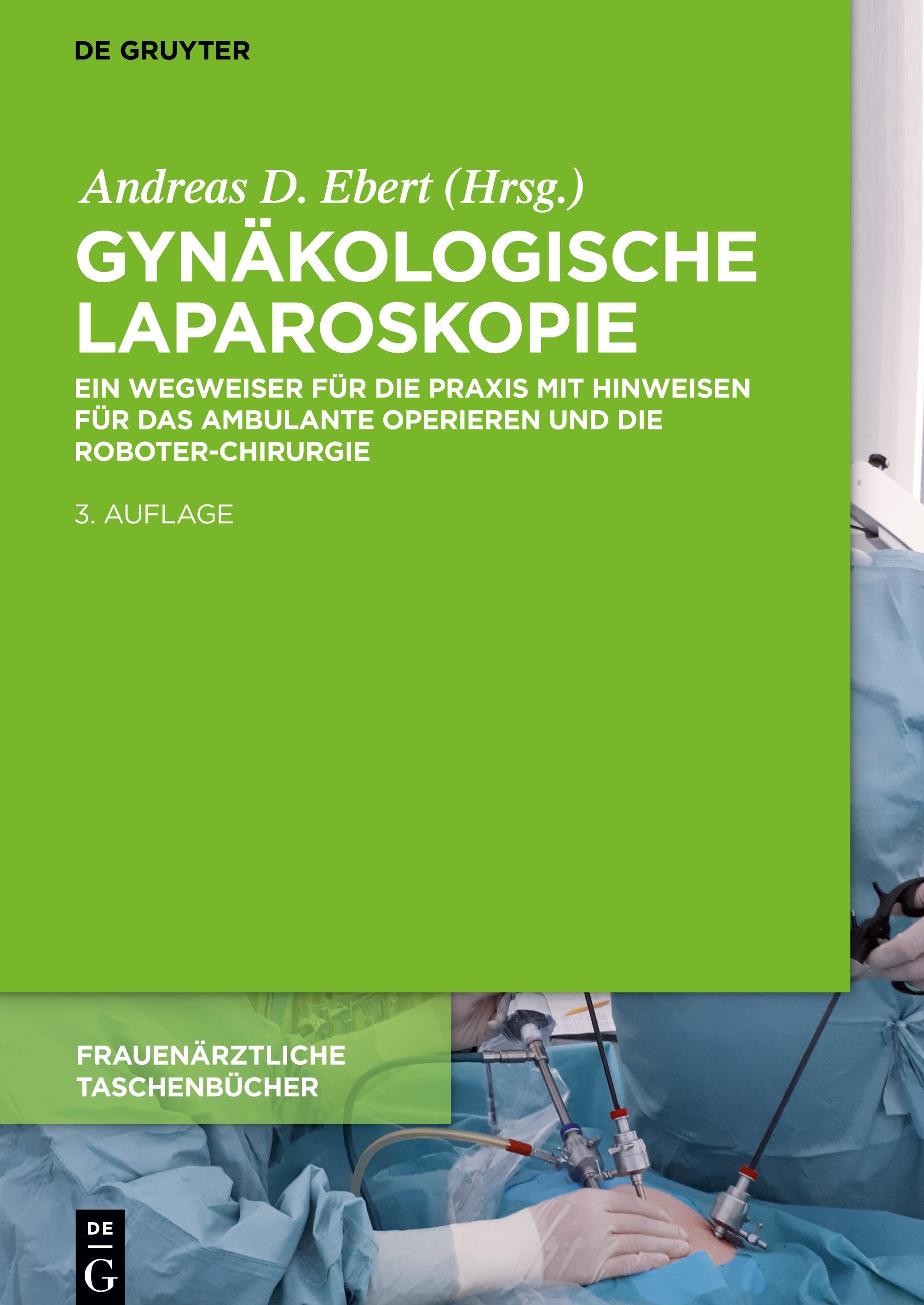 Vorderes Coverbild Gynäkologische Laparoskopie