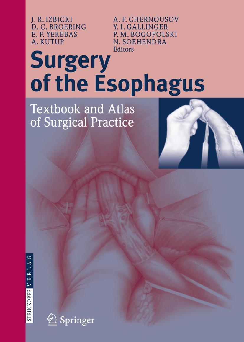 Vorderes Coverbild Surgery of the Esophagus