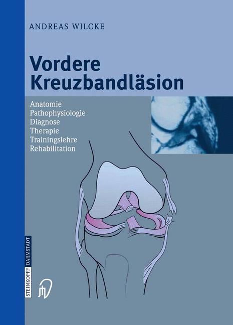 Vorderes Coverbild Vordere Kreuzbandläsion