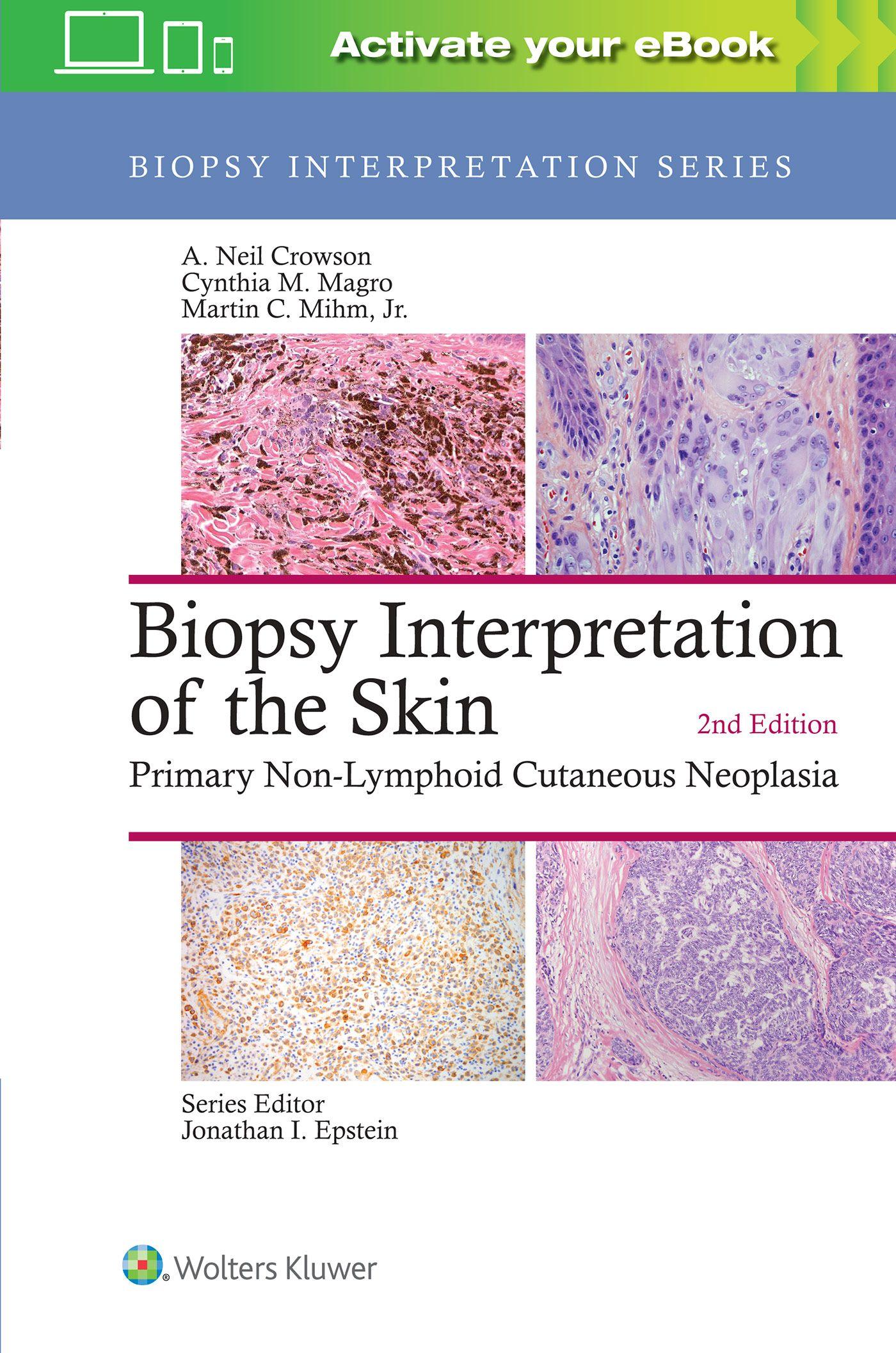 Vorderes Coverbild Biopsy Interpretation of the Skin